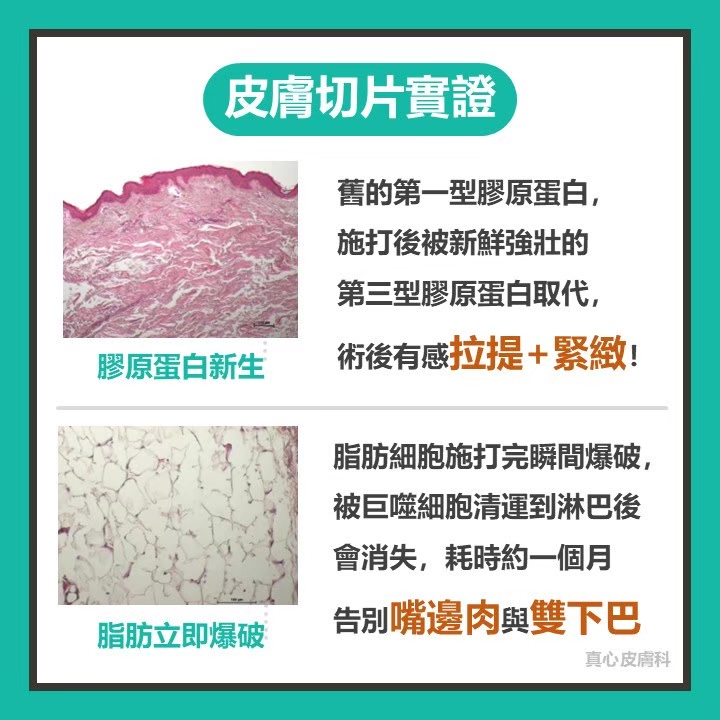 Onda超微波推薦