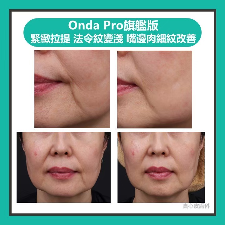 Onda超微波推薦