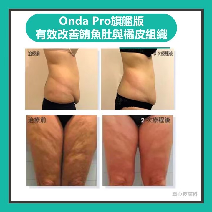 Onda超微波推薦
