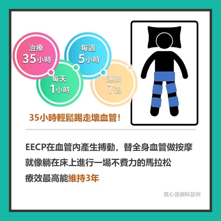 心臟衰竭