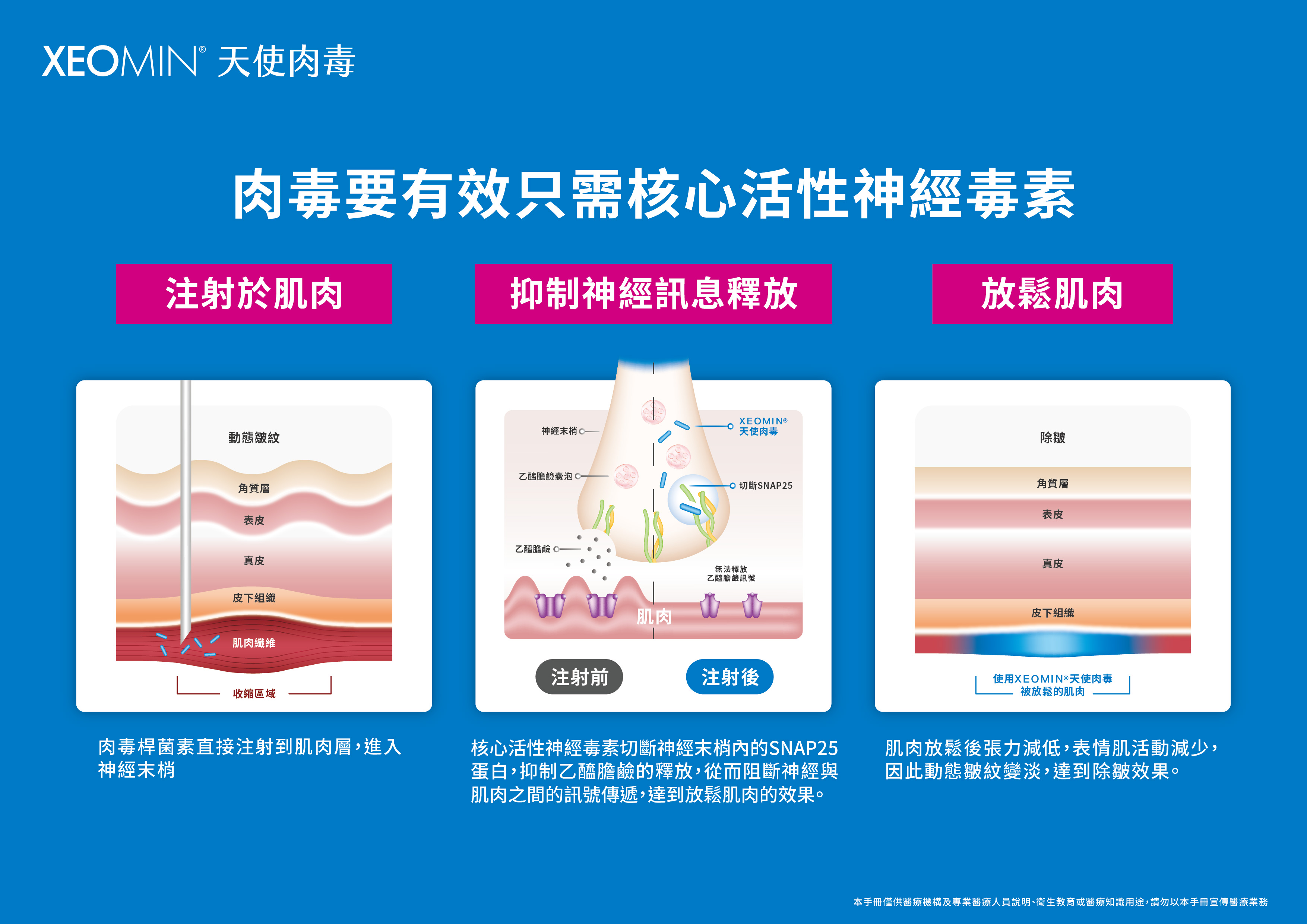 肉毒 效果