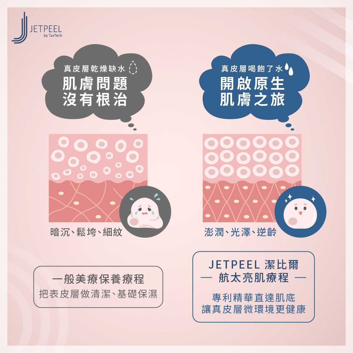 潔比爾效果