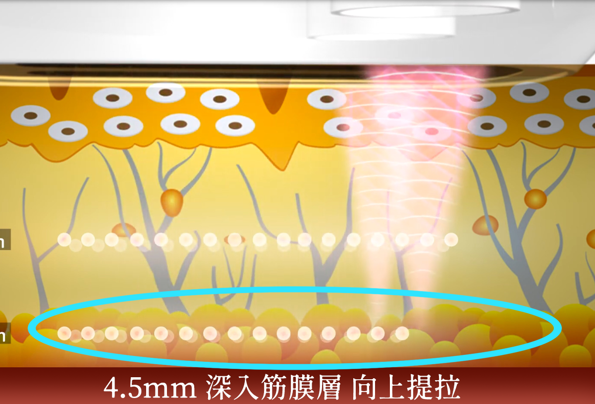 雙線音波效果