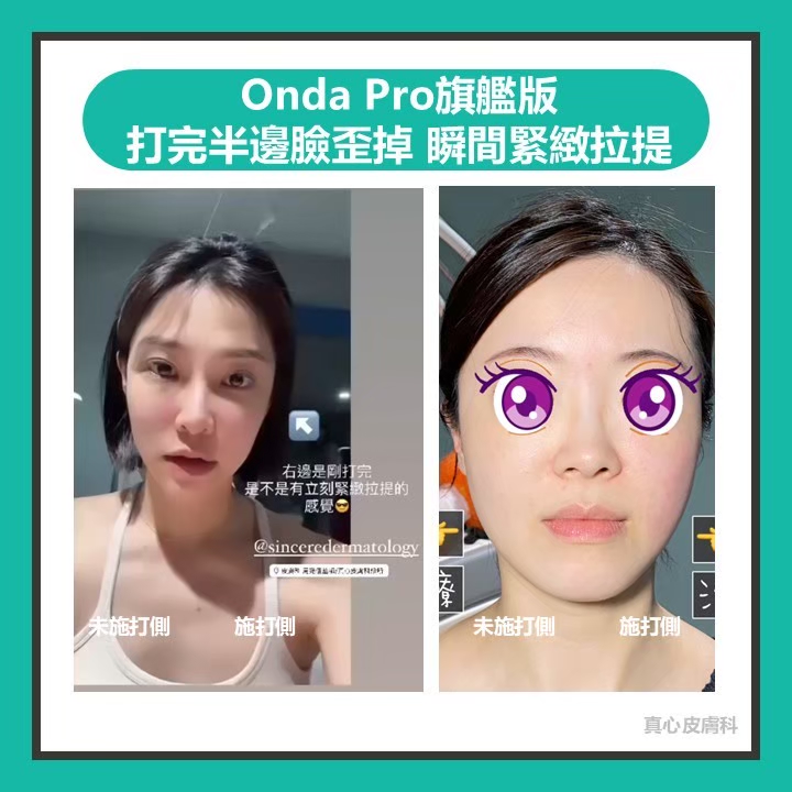 Onda超微波推薦