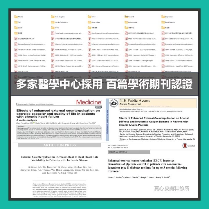 eecp有效嗎
