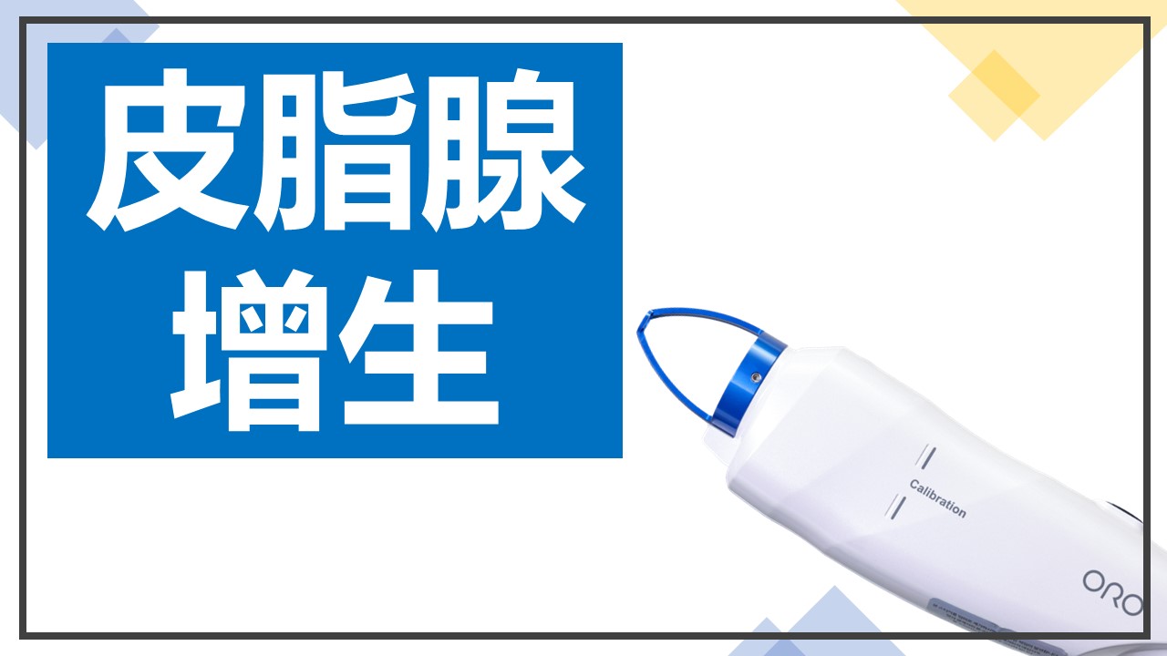 藍雷射價格
