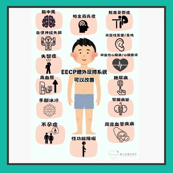 EECP效果