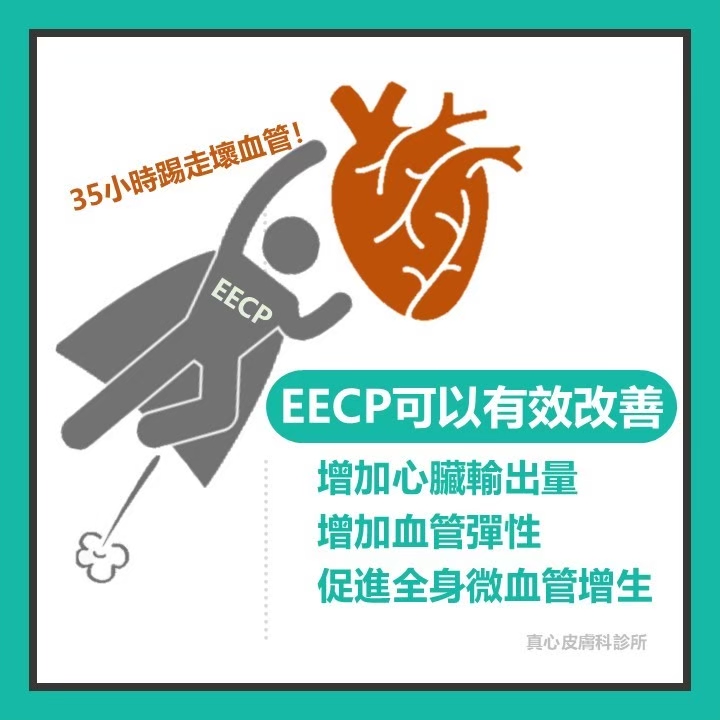 eecp有效嗎