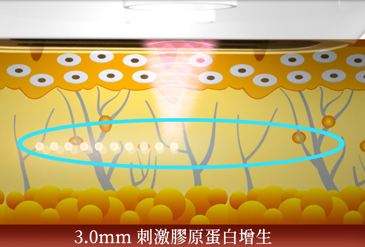 雙線音波效果