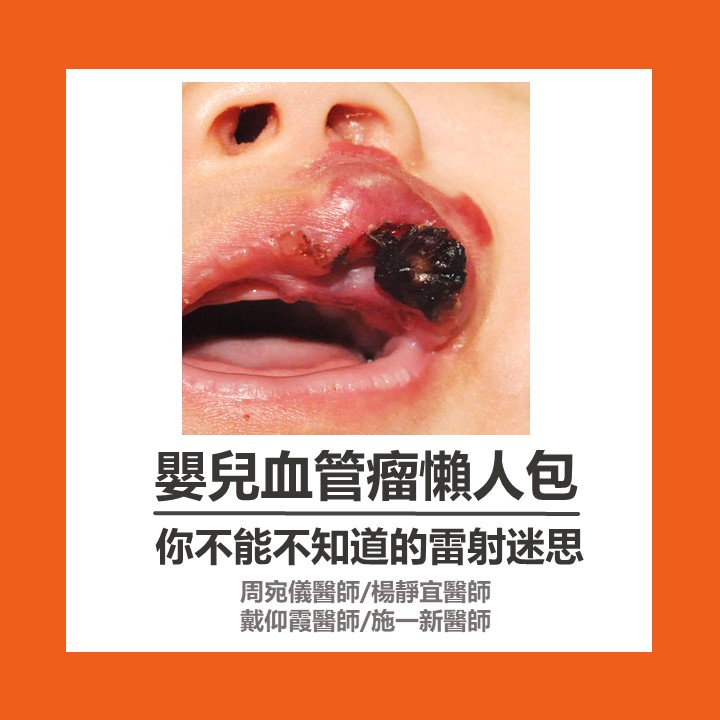 嬰兒血管瘤懶人包雷射篇 封面
