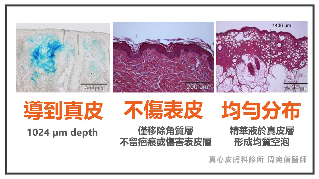 潔比爾
