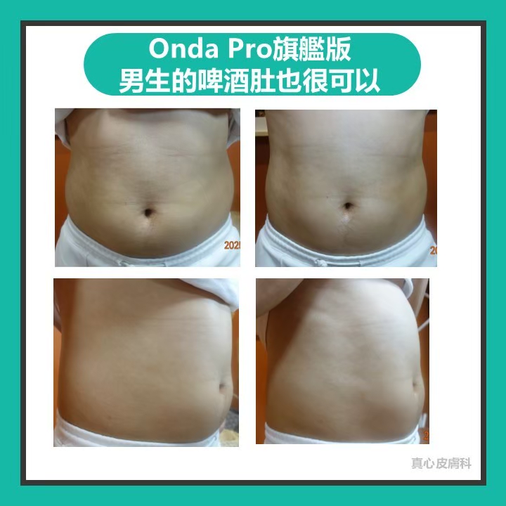 Onda超微波推薦
