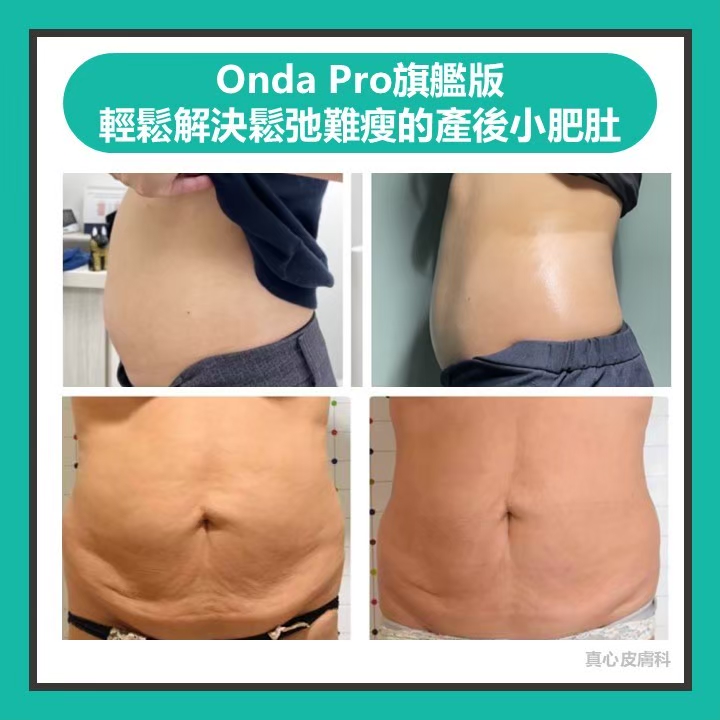 Onda超微波推薦