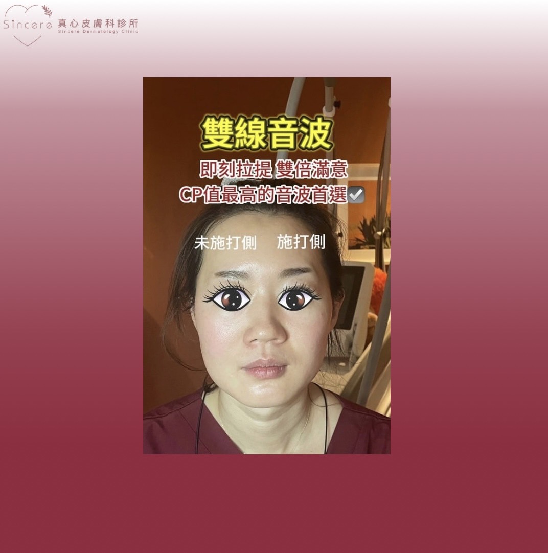雙線音波效果