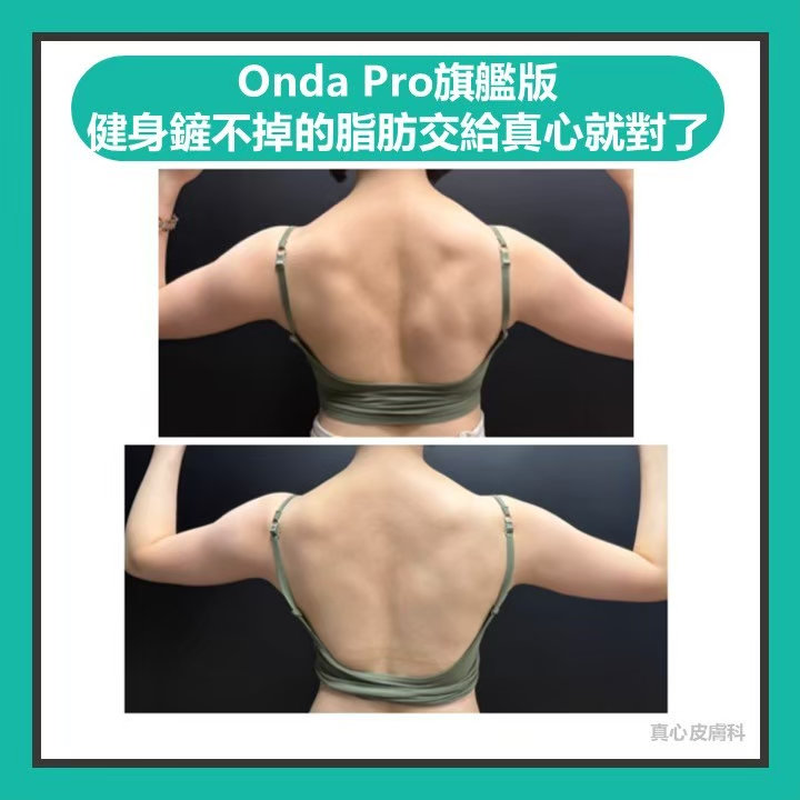 健身 onda