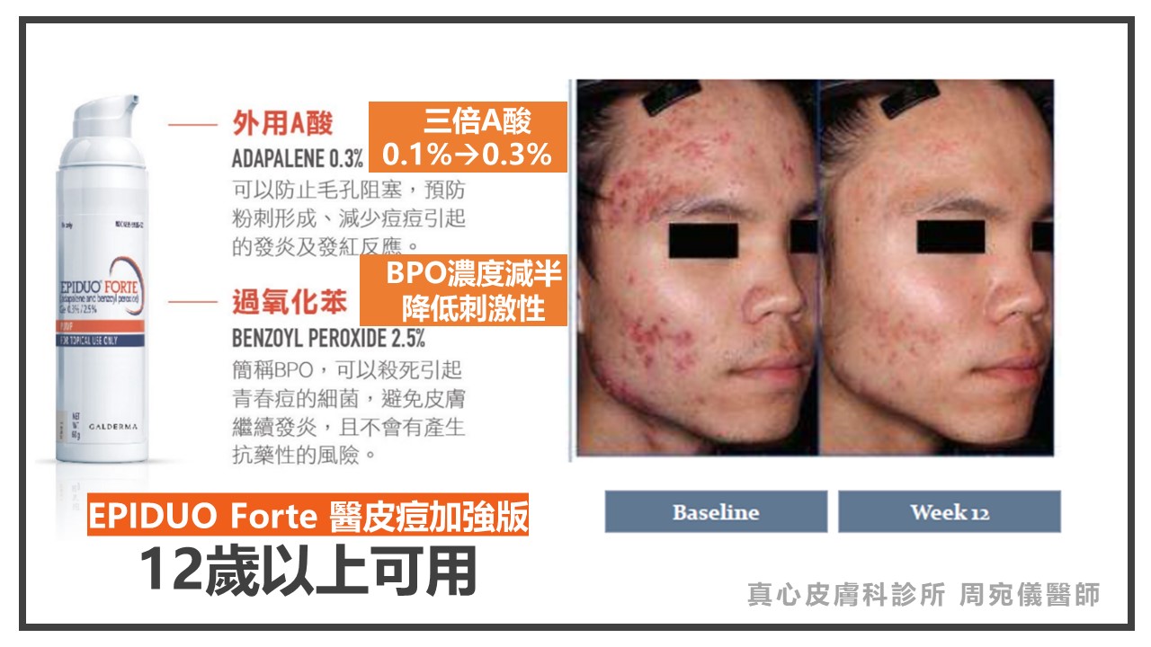 醫皮痘