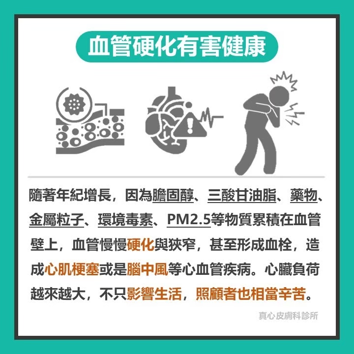 血管硬化