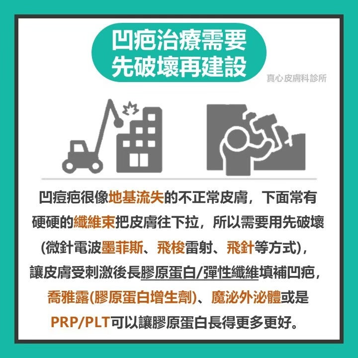 凹痘疤