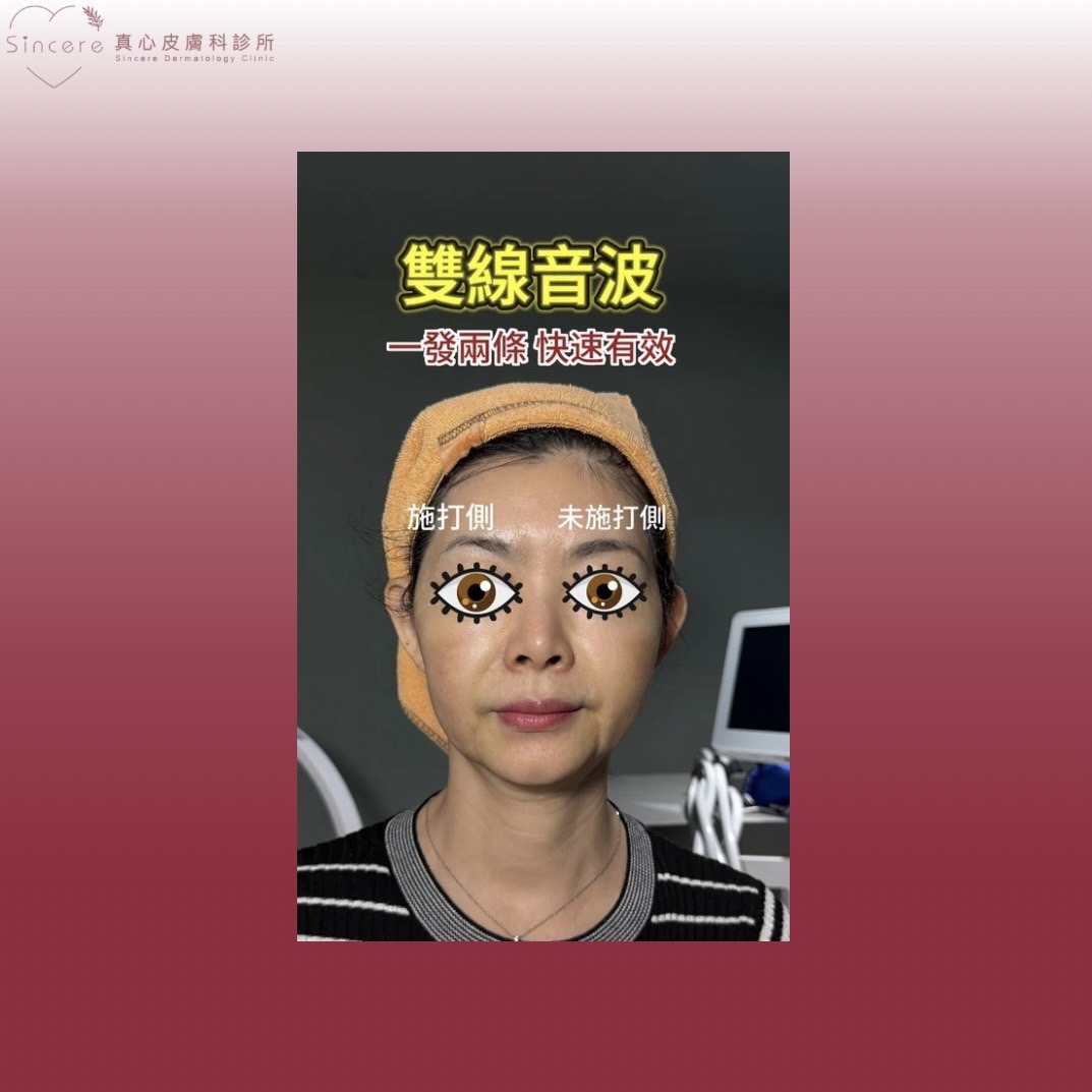 雙線音波效果