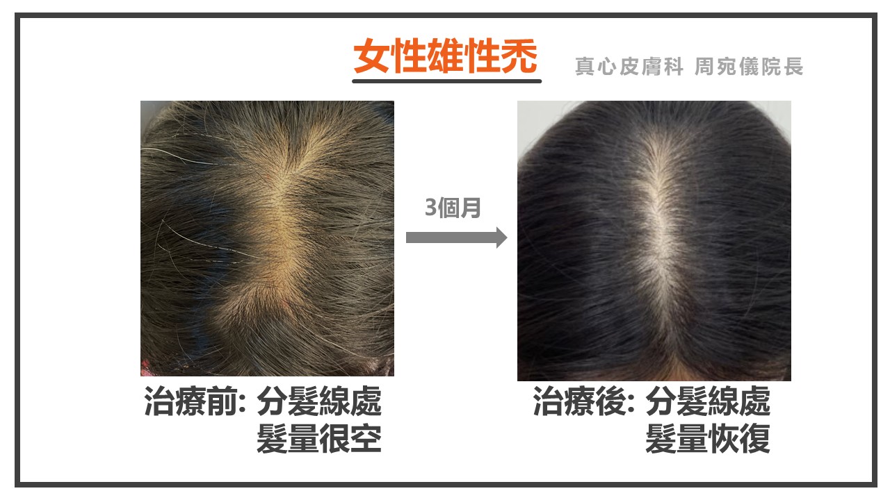 落髮怎麼辦
