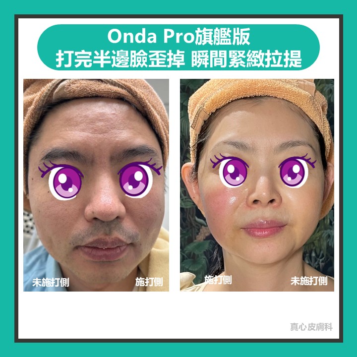 onda